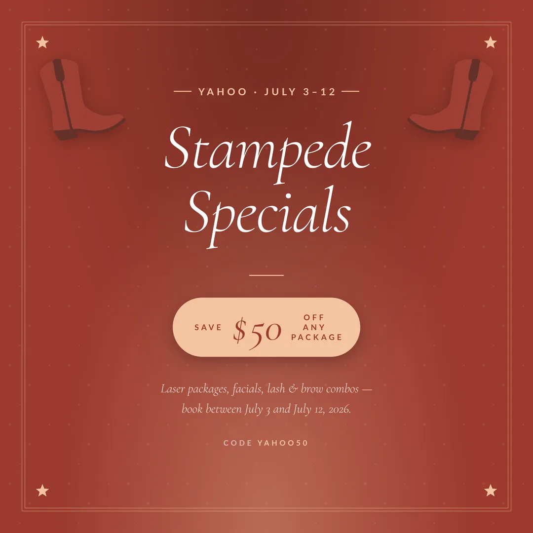 Stampede specials post